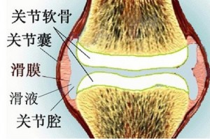 经常掰手指会导致关节炎吗1
