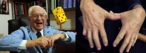 经常掰手指会导致关节炎吗3