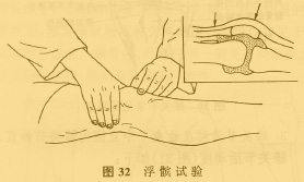 髌股疼痛图片5